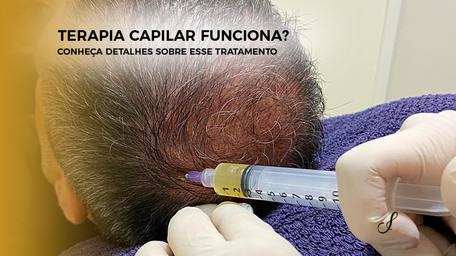 Capa Artigo Modelo 01 - Terapia Capilar Funciona