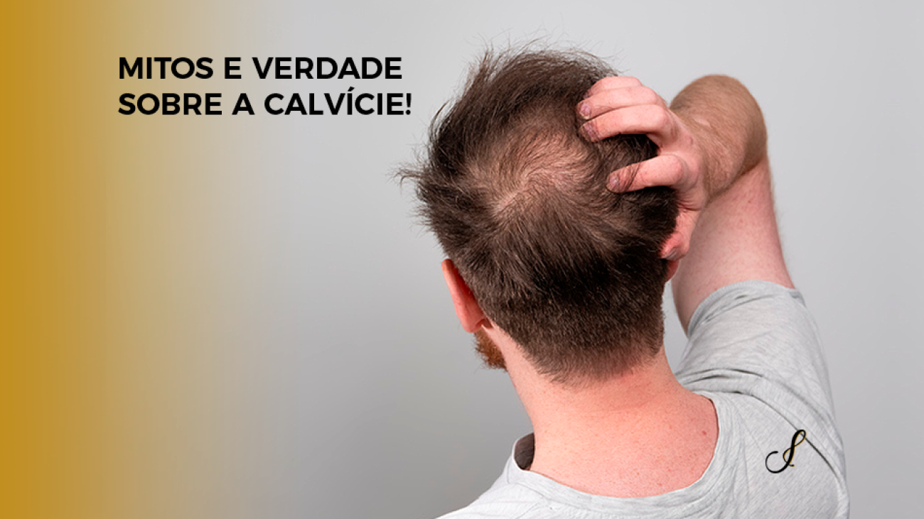 Mitos e Verdades Sobre a Calvície