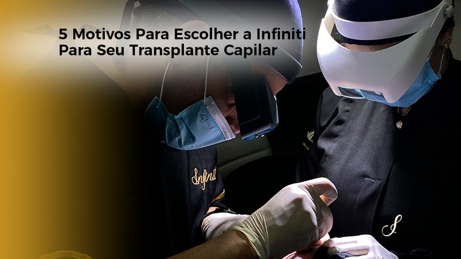 5 Motivos Para Escolher a Infiniti Para Seu Transplante Capilar